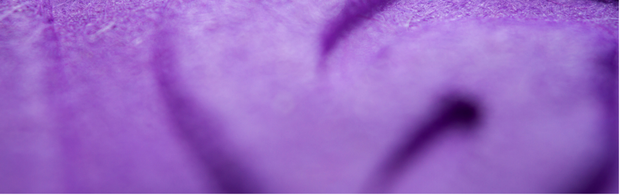 Embossed